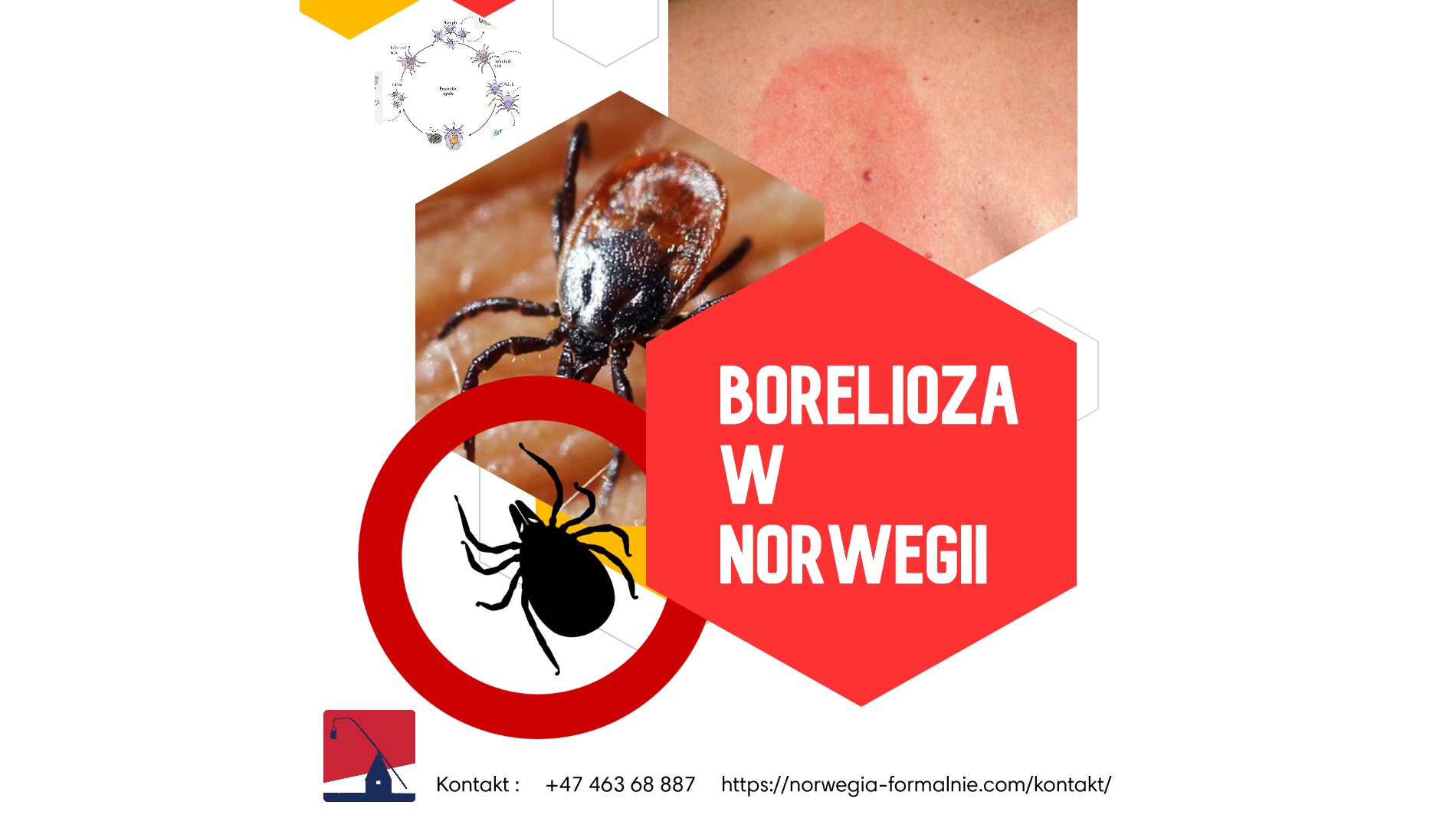 Borelioza i inne choroby odkleszczowe w Norwegii